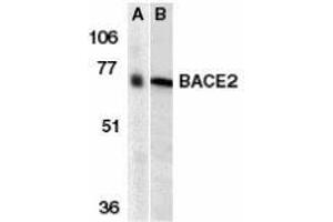 Western blot analysis of BACE2 in human (A) and mouse (B) heart tissue lysates with AP30112PU-N BACE2 antibody at 1 μg/ml.