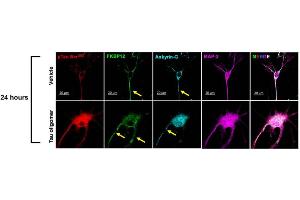 Representative images showed the high expression level of FKBP12 (green) in axonal hillock/axon initial segment (labeled by anti-ankyrin-G antibody, cat.