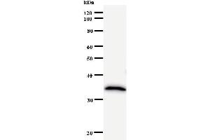 Western Blotting (WB) image for anti-Zinc Finger Protein 44 (ZNF44) antibody (ABIN931076) (Zinc Finger Protein 44 anticorps)