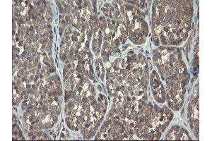 Image no. 4 for anti-ADP-Ribosylation Factor-Like 2 Binding Protein (ARL2BP) antibody (ABIN1496715)