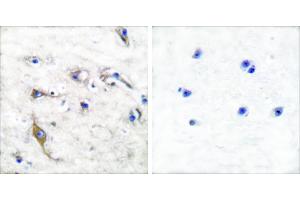 Peptide - +Immunohistochemical analysis of paraffin-embedded human brain tissue using JM4 antibody (#C0238). (PRAF2 anticorps)