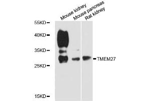Western blot analysis of extracts of various cell lines, using TMEM27 antibody (ABIN6292811) at 1:3000 dilution. (TMEM27 anticorps)