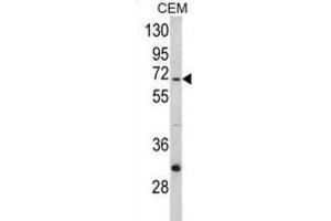 Western Blotting (WB) image for anti-Mitochondrially Encoded NADH Dehydrogenase 5 (MT-ND5) antibody (ABIN3002895) (MT-ND5 anticorps)