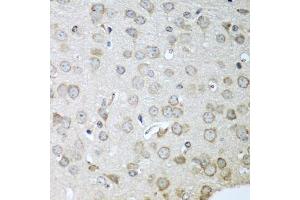 Immunohistochemistry of paraffin-embedded mouse brain using CDH11 antibody (ABIN5974785) at dilution of 1/100 (40x lens). (OB Cadherin anticorps)