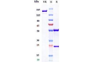Anti-CCL5 / RANTES Reference Antibody (VLST-002) on SDS-PAGE under reducing (R) condition.
