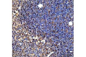 IHC analysis of SYK using anti-SYK antibody (ABIN7599608). (SYK anticorps  (AA 10-635))