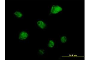 Immunofluorescence of purified MaxPab antibody to RBM6 on HeLa cell.