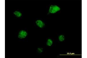 Immunofluorescence of purified MaxPab antibody to RBM6 on HeLa cell. (RBM6 anticorps  (AA 1-601))