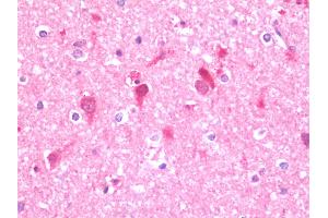 Anti-UFD2A / UBE4B antibody IHC staining of human brain, cortex. (UBE4B anticorps  (AA 869-1179))