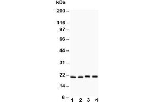 Western blot testing of Caveolin-1 antibody and Lane 1:  HeLa;  2: HT1080;  3: human placenta;  4: A431 (Caveolin-1 anticorps  (AA 4-178))
