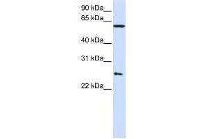 CCT7 antibody used at 1 ug/ml to detect target protein. (CCT7 anticorps)