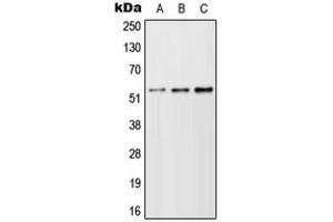 Western blot analysis of TFEB expression in A549 (A), NIH3T3 (B), H9C2 (C) whole cell lysates. (TFEB anticorps  (N-Term))