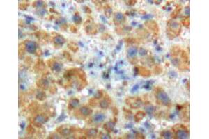 Used in DAB staining on fromalin fixed paraffin- embedded Kidney tissue