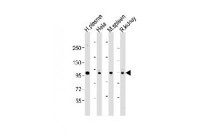 All lanes : Anti-GSN Antibody (N-term) at 1:1000-1:2000 dilution Lane 1: human plasma lysates Lane 2: Hela whole cell lysates Lane 3: mouse spleen lysates Lane 4: rat kidney lysates Lysates/proteins at 20 μg per lane. (Gelsolin anticorps  (N-Term))