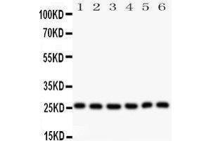 Observed bind size: 26KD (Galectin 3 anticorps  (AA 139-250))