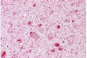 Anti-MCM3 antibody IHC staining of human brain, cortex.