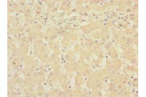 Immunohistochemistry of paraffin-embedded human liver tissue using ABIN7168232 at dilution of 1:100 (RCHY1 anticorps  (AA 1-261))