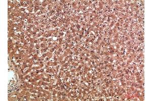 Immunohistochemical analysis of paraffin-embedded human-liver, antibody was diluted at 1:200