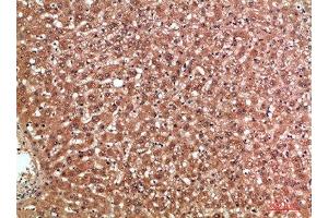 Immunohistochemical analysis of paraffin-embedded human-liver, antibody was diluted at 1:200 (MBL2 anticorps  (AA 21-70))