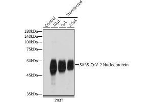 Western blot analysis of extracts of normal 293T cells and 293T transfected with Nucleoprotein,using SARS-CoV-2 Nucleoprotein antibody (ABIN7269053) at 1:1000 dilution. (Nucleoprotein anticorps)
