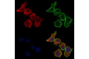 ABIN6260777 and ABIN6277148 staining HepG2 cells by IF/ICC. (Complement Factor H anticorps  (N-Term))