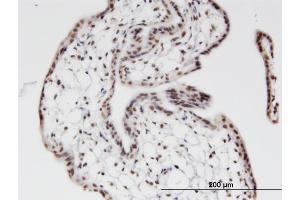 Immunoperoxidase of monoclonal antibody to ZNF397 on formalin-fixed paraffin-embedded human placenta.