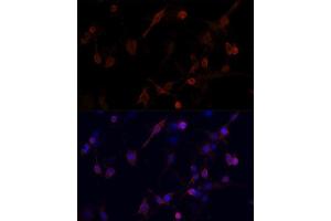 Immunofluorescence analysis of PC12 cells using CFL1 antibody.