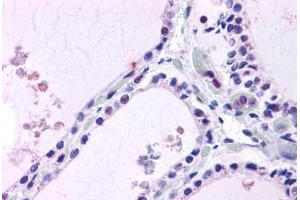 Thyroid, Human: Formalin-Fixed, Paraffin-Embedded (FFPE)