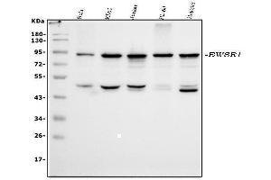 Western blot analysis of EWSR1 using anti-EWSR1 antibody (ABIN3043825). (EWSR1 anticorps  (Middle Region))