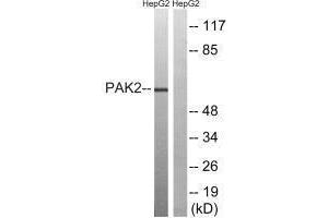 Western blot analysis of extracts from HepG2 cells, treated with serum (20 % , 15 mins), using PAK2 (Ab-192) antibody. (PAK2 anticorps  (Ser192))