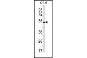 Western blot analysis of KCNJ4 Antibody (N-term) in CEM cell line lysates (35ug/lane). (KCNJ4 anticorps  (N-Term))