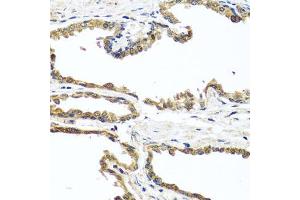 Immunohistochemistry of paraffin-embedded human prostate using OGFR antibody (ABIN5974255) at dilution of 1/100 (40x lens). (OGFR anticorps)
