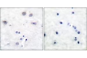 Immunohistochemistry (IHC) image for anti-SHC (Src Homology 2 Domain Containing) Transforming Protein 1 (SHC1) (AA 393-442) antibody (ABIN2888576) (SHC1 anticorps  (AA 393-442))