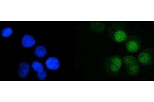 IF analysis of MRE11 using anti-MRE11 antibody (ABIN7600025). (Mre11 anticorps  (AA 14-481))