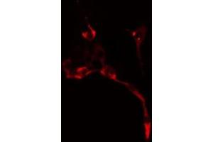 ABIN6278630 staining  NIH-3T3 cells by IF/ICC. (URI1 anticorps  (Internal Region))