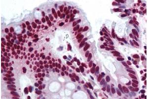 Human Colon (formalin-fixed, paraffin-embedded) stained with THRAP3 antibody ABIN290234 at 10 ug/ml followed by biotinylated goat anti-rabbit IgG secondary antibody ABIN481713, alkaline phosphatase-streptavidin and chromogen. (THRAP3 anticorps  (AA 930-955))