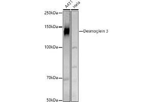 Western blot analysis of extracts of various cell lines, using Desmoglein 3 antibody (ABIN6127804, ABIN6139833, ABIN6139834 and ABIN6224465) at 1:500 dilution. (Desmoglein 3 anticorps  (AA 749-999))