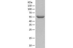 Western Blotting (WB) image for Matrix Metalloproteinase 2 (MMP2) (AA 109-660) protein (His tag) (ABIN7123863) (MMP2 Protein (AA 109-660) (His tag))