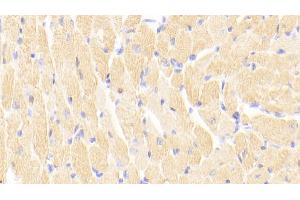 Detection of cTnI in Mouse Cardiac Muscle Tissue using Polyclonal Antibody to Cardiac Troponin I (cTnI) (TNNI3 anticorps  (AA 1-211))