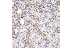 Immunohistochemistry of paraffin-embedded rat kidney using KEAP1 antibody.