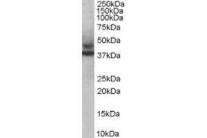 Western Blotting (WB) image for anti-Tripartite Motif Containing 54 (TRIM54) (C-Term) antibody (ABIN2465974) (TRIM54 anticorps  (C-Term))