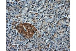 Immunohistochemical staining of paraffin-embedded colon tissue using anti-PPP5C mouse monoclonal antibody. (PP5 anticorps)