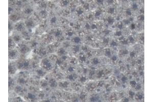 Detection of AGT in Rat Liver Tissue using Monoclonal Antibody to Angiotensinogen (AGT)