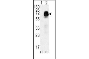 Western blot analysis of AMHR2(arrow) using rabbit polyclonal AMHR2 Antibody (AMHR2 anticorps  (N-Term))