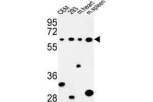 Western Blotting (WB) image for anti-Phospholipase C zeta 1 (PLCz1) antibody (ABIN3004174)