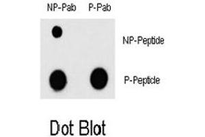 Dot blot analysis of MEF2C (phospho T300) polyclonal antibody  and MEF2C Non Phospho-specific polyclonal antibody on nitrocellulose membrane.