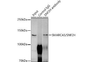 Immunoprecipitation analysis of 300 μg extracts of HeLa cells using 3 μg SM/SNF2H antibody (ABIN7270656).