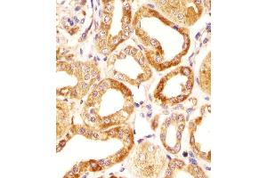 Immunohistochemical analysis of paraffin-embedded H.