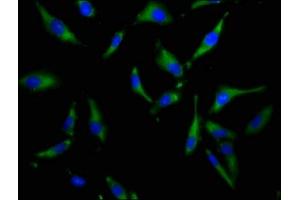 Immunofluorescence staining of Hela cells with ABIN7169994 at 1:100, counter-stained with DAPI. (SLC34A3 anticorps  (AA 1-76))