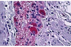 Human Colon, Peripheral Nerve: Formalin-Fixed, Paraffin-Embedded (FFPE)